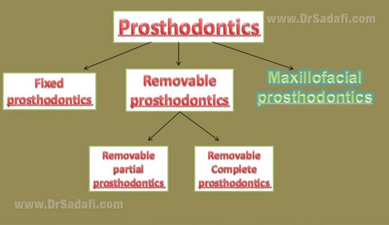 پروتز های دندانی