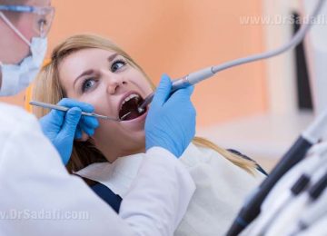 Root Canal Therapy