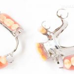 Dental prosthesis