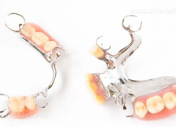 Dental prosthesis